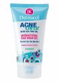 Dermacol Acneclear Antibakteriln myc gel 150ml